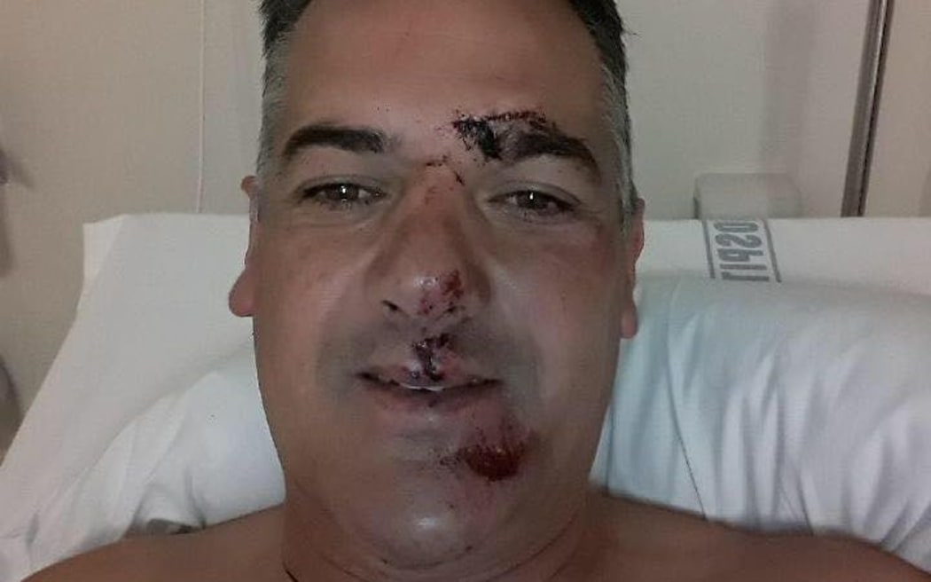 Wade Rollo after his accident.