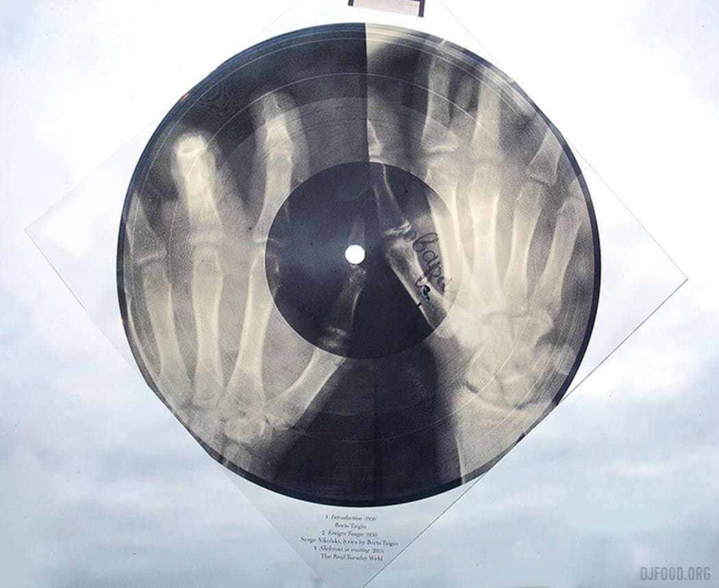 Copyright X-Ray Audio and Antique Beat 2014.