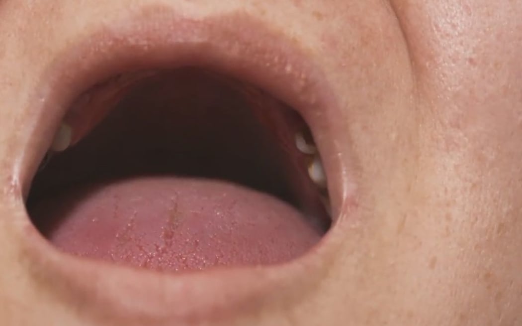 Jill says money keeps her from getting her teeth fixed.
