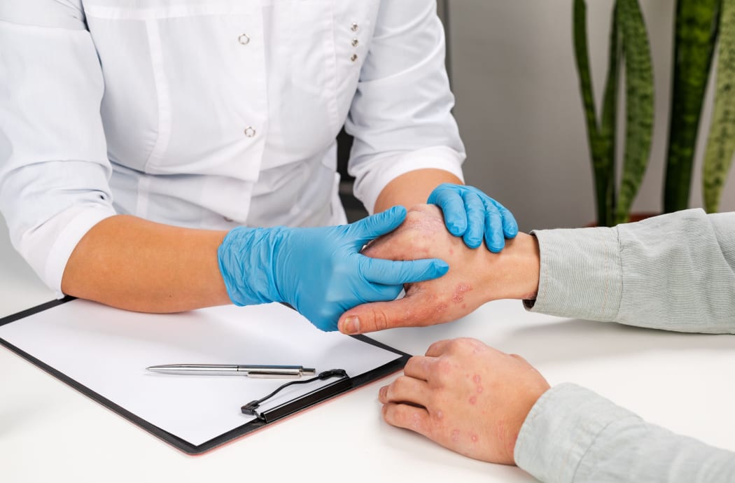 A dermatologist wearing gloves examines the skin of a sick patient. Examination and diagnosis of skin diseases-allergies, psoriasis, eczema, dermatitis.