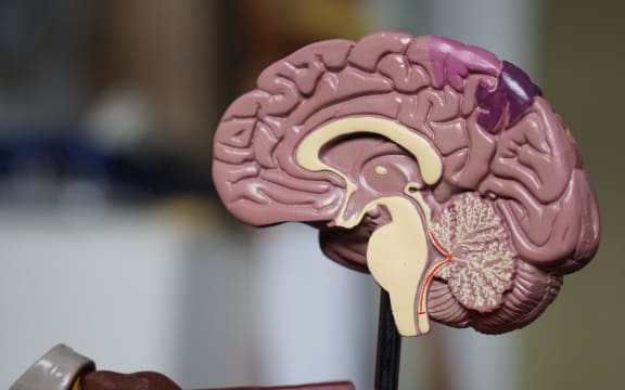 A model of a human brain