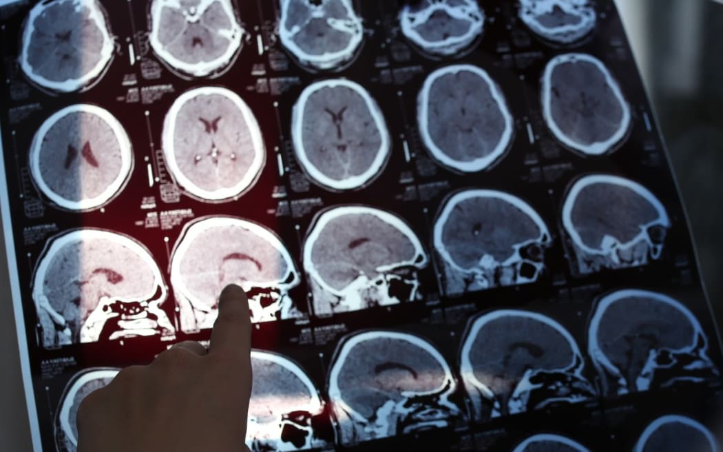 Brain scans.