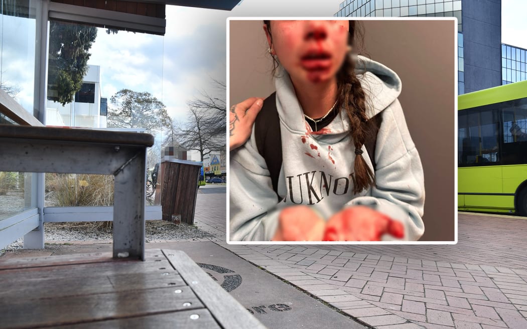 A 13-year-old girl was left bloodied after being assaulted at an Arawa St bus stop in August.