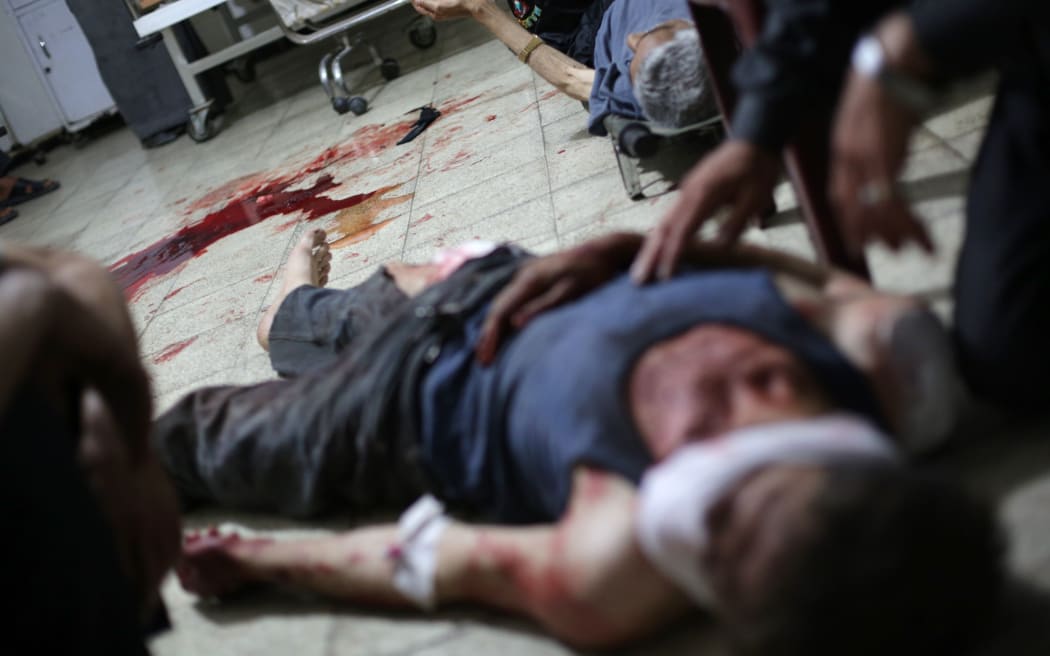 The injured treated at a medical center following shelling in the city of Douma, northeast of the capital Damascus.