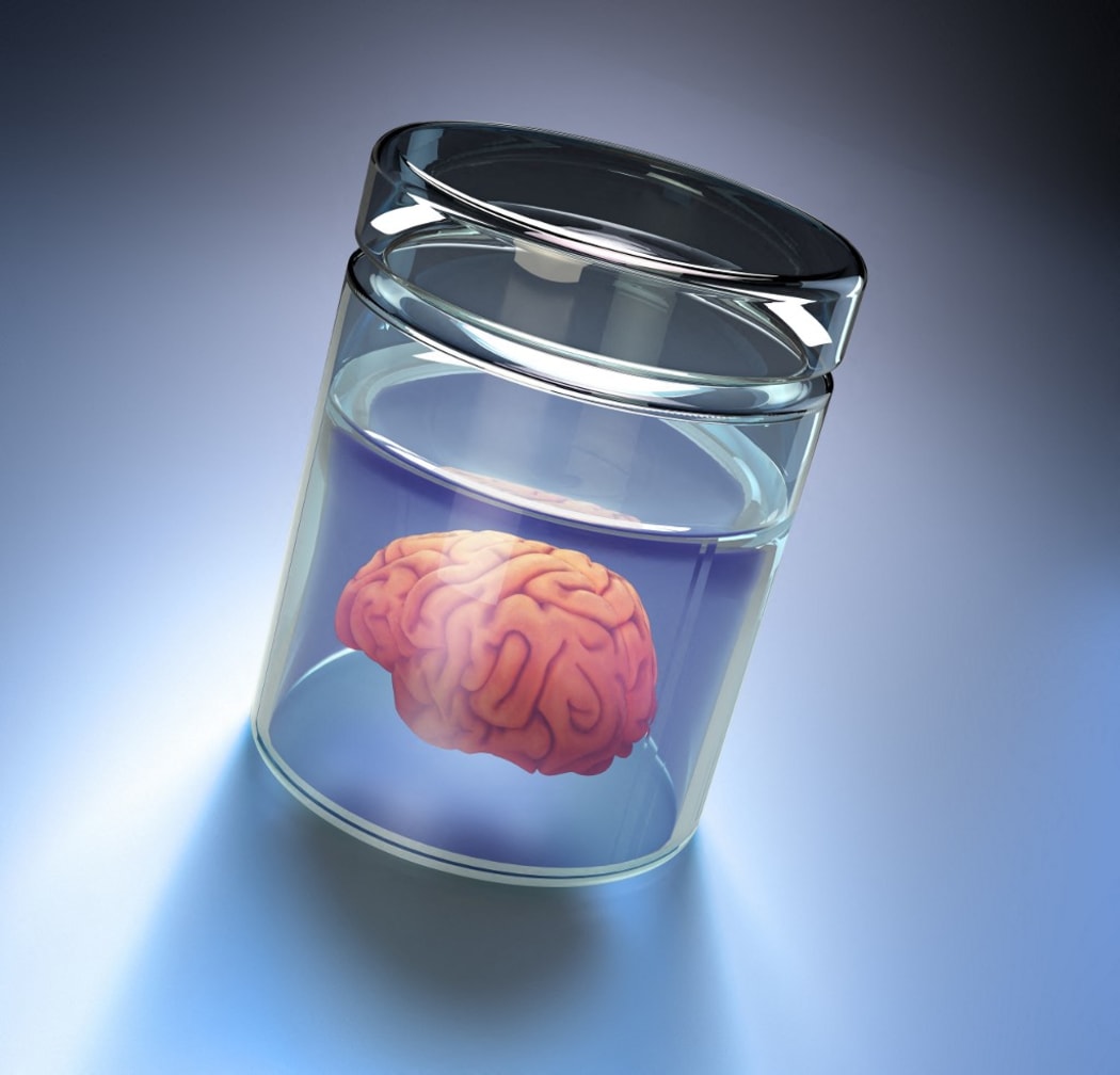 Human brain in a glass jar, computer illustration. (Photo by Mopic / AWO / Science Photo Library via AFP)