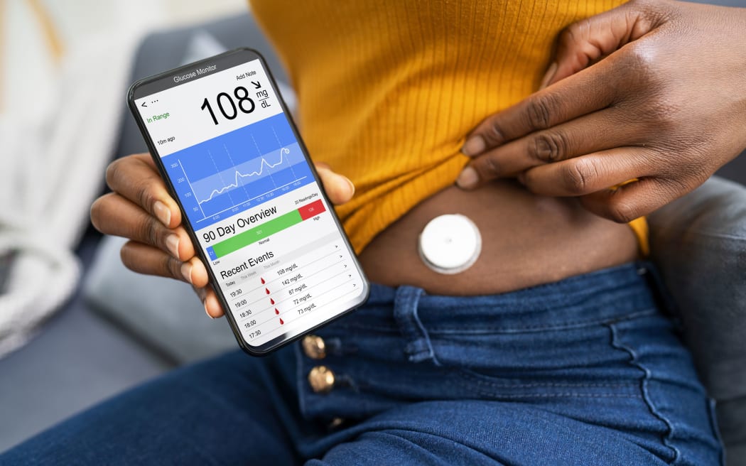 Continuous Glucose Monitor Blood Sugar Test Smart Phone App