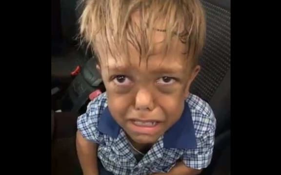 Quaden Bayles has tears in his eyes in a screenshot from a video his mother, Yarraka, posted on Facebook showing him talking about how he is bullied.