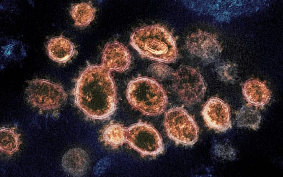 Novel Coronavirus SARS-CoV-2 This transmission electron microscope image shows SARS-CoV-2, the virus that causes Covid-19, isolated from a patient in the US. Virus particles are shown emerging from the surface of cells cultured in the lab.