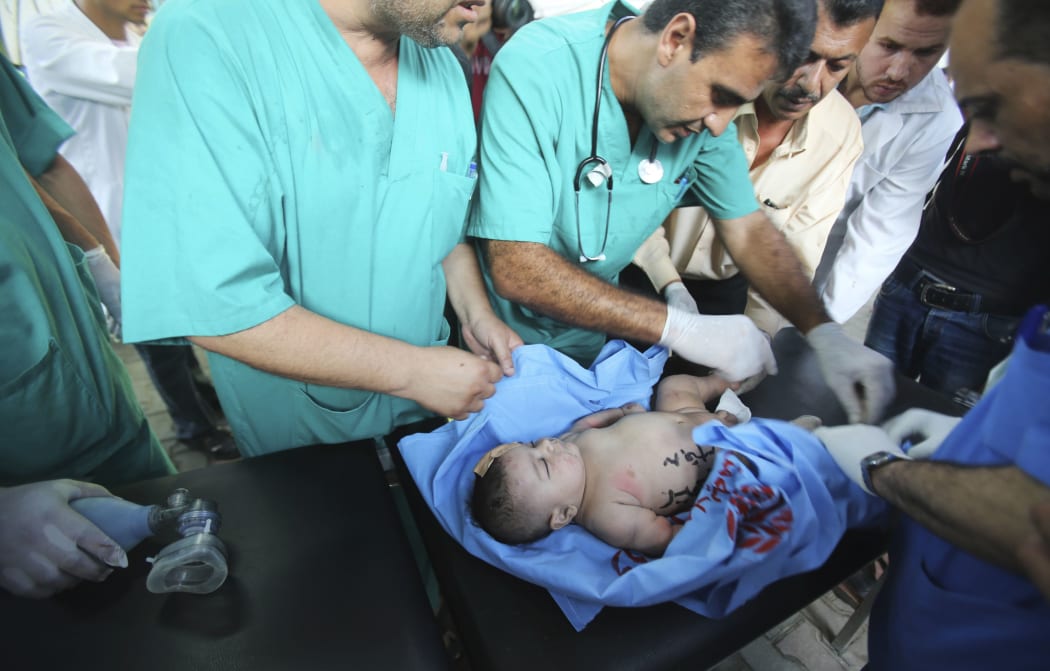 Palestinian medics treat an infant, who medics said was wounded in an Israeli air strike.