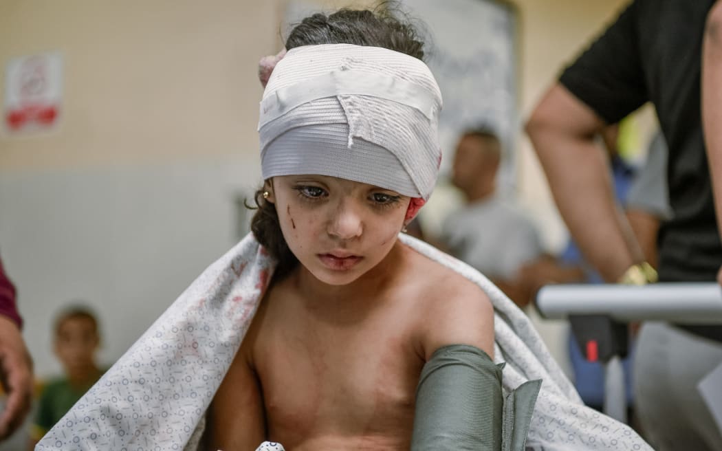 Khan Yunis, Palastine. A Palestinian girl, bearing the visible wounds of an Israeli airstrike on October 17, 2023, receives treatment at Nasser Hospital in Khan Yunis, situated in the southern Gaza Strip. Her bandaged head and weary expression reveal the grim toll of the ongoing conflict