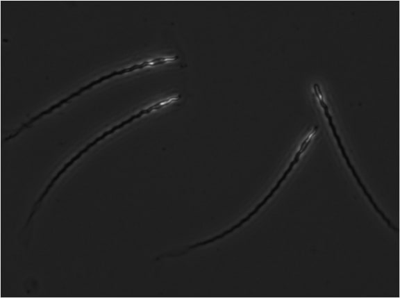 Sperm with long tadpole-like tails