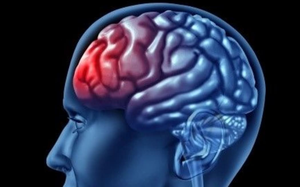 Brain profile showing pre-frontal cortex.