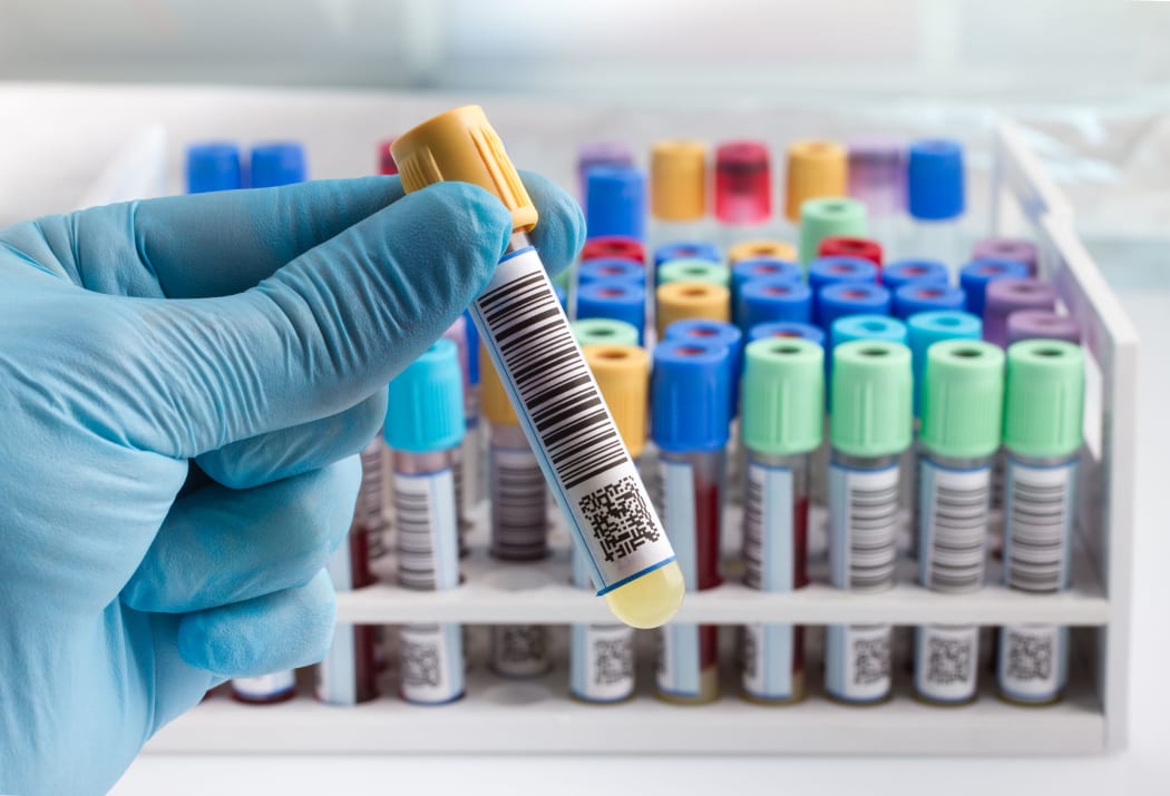 A lab technician holding blood tube test.