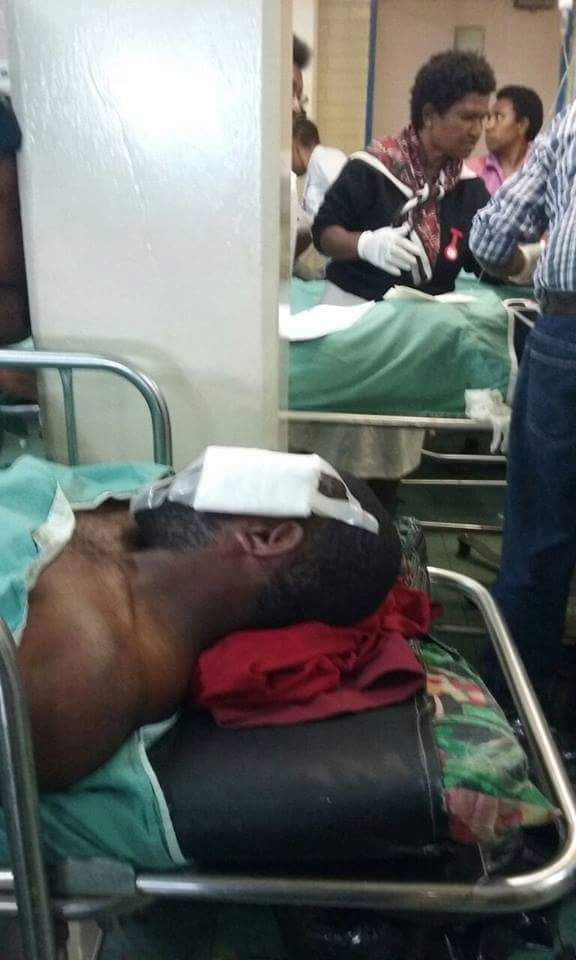 Injured students in Goroka Hospital, Papua New Guinea, 14 June 2016.