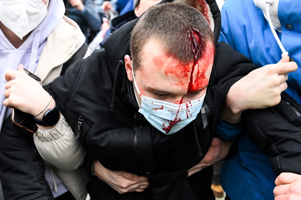 An injured man is helped by other protesters during a rally in support of jailed opposition leader Alexei Navalny in downtown Moscow on January 23, 2021. -