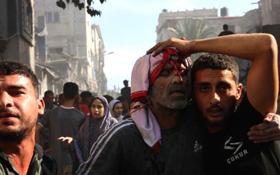 EDITORS NOTE: Graphic content / A Palestinian man is helped following an Israeli air strike on a home in Rafah, in the southern Gaza Strip on October 30 , 2023, amid the ongoing battles between Israel and the Palestinian group Hamas. Thousands of civilians, both Palestinians and Israelis, have died since October 7, 2023, after Palestinian Hamas militants based in the Gaza Strip entered southern Israel in an unprecedented attack triggering a war declared by Israel on Hamas with retaliatory bombings on Gaza. (Photo by SAID KHATIB / AFP)