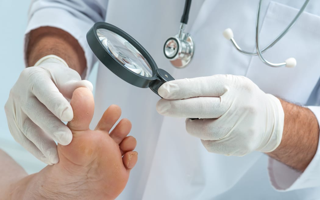 Doctor dermatologist examines the foot on the presence of athletes foot