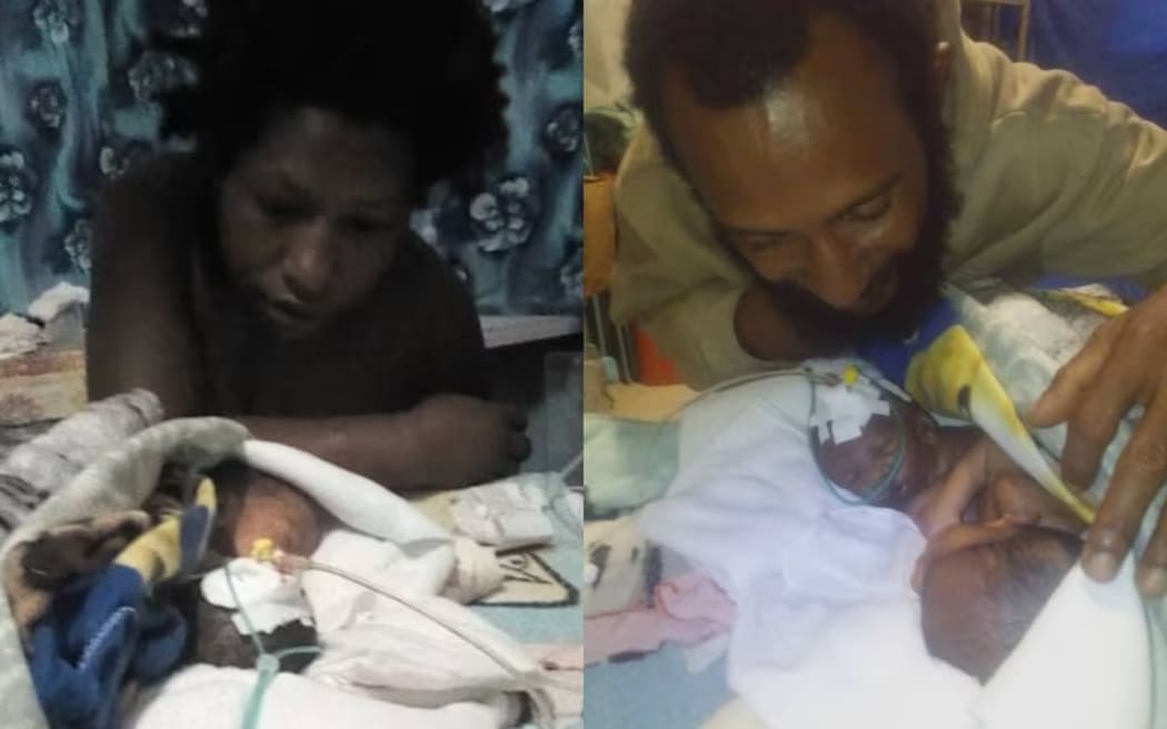 Mother Fatima and father Kevin seen looking at their newborn conjoined twins. (Supplied)