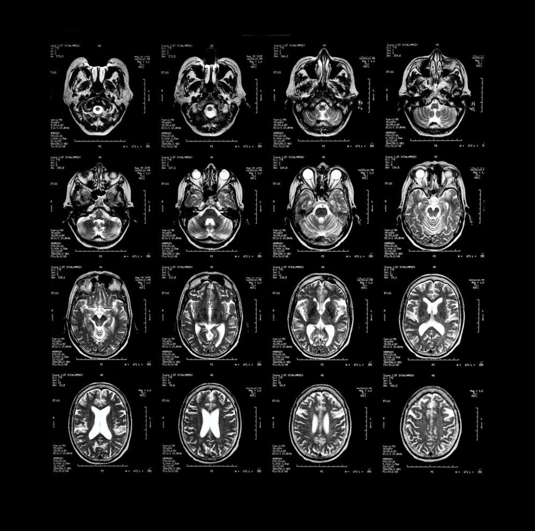 Psychopath brain scans
