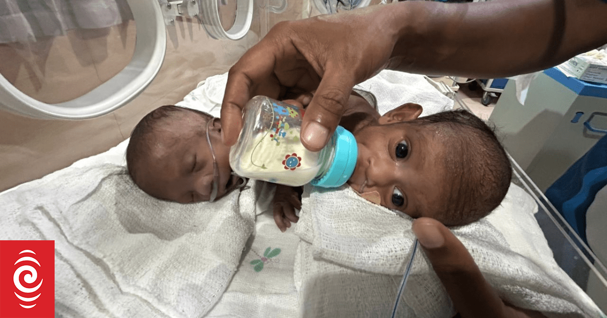 Critical assessment underway for PNG's conjoined twins by Australian doctors