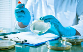 Germs growing on an agar plate in laboratory