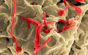 The Ebola virus budding from a cell.