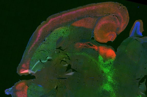 False colour image of a rat brain