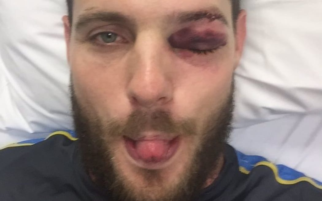 Mitchell McClenaghan copped a shiner in Black Caps win over Pakistan at the Basin Reserve.