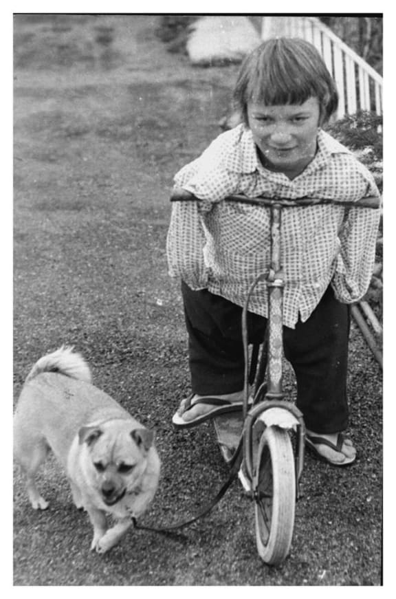 Barry De Geest was happy to forego artifical limbs.