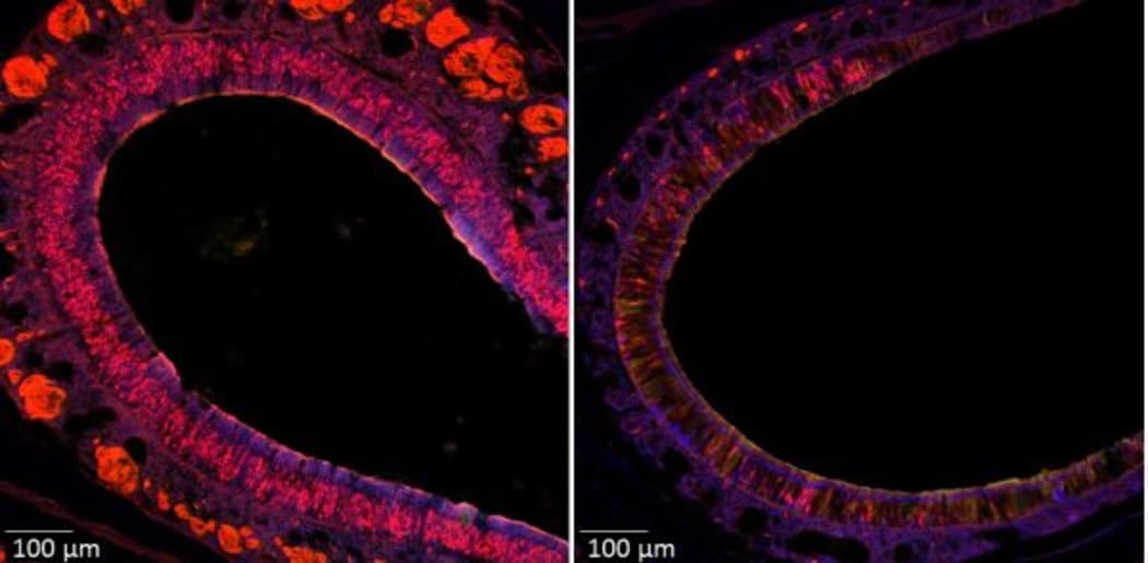 Ablation of olfactory neurons in the nose using a genetic method, on the right this is the mouse without smell (the red neurons are ablated) compared to its control.