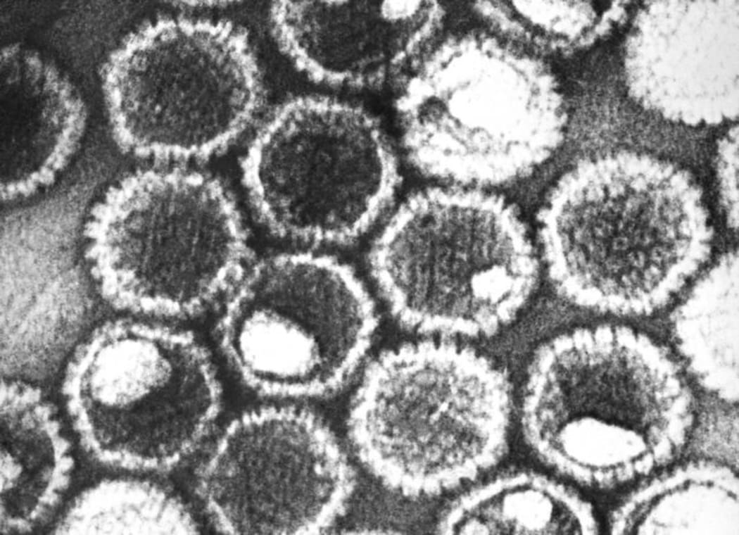Herpes Simplex Virus