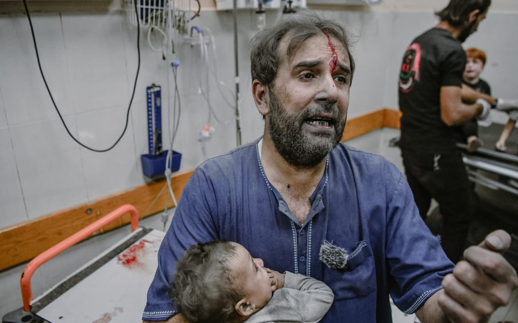 Khan Yunis, Palastine. Injured Palestinian children at Nasser Hospital in Khan Yunis, located in the southern Gaza Strip, following an Israeli airstrike on October 17, 2023.