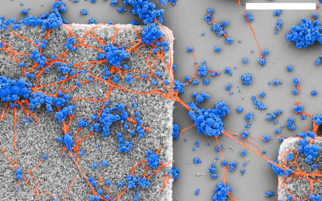Neurons from the retina form networks on the patterned surface of an electrode fabricated at the University of Oregon, USA.