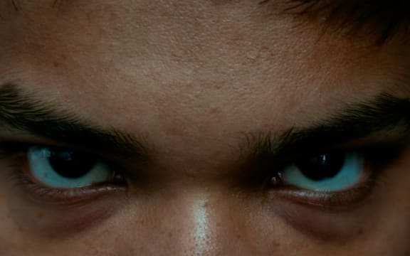 People with psychopathy typically show problems in responding to other people’s suffering.