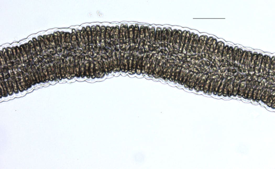 Dione arcuata, or eyelash seaweed, under a microscope