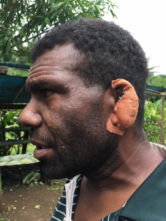Chief George Natau who was one of the people hurt by stone throwing youths