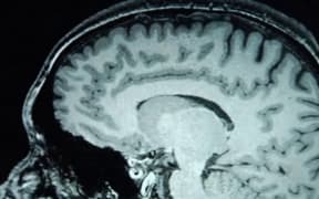brain scan