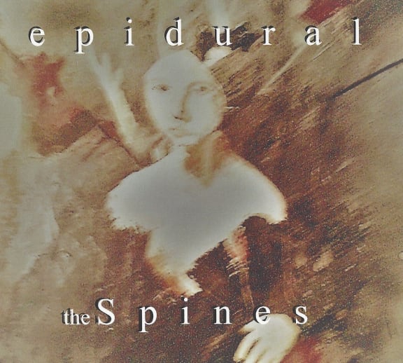 Epidural