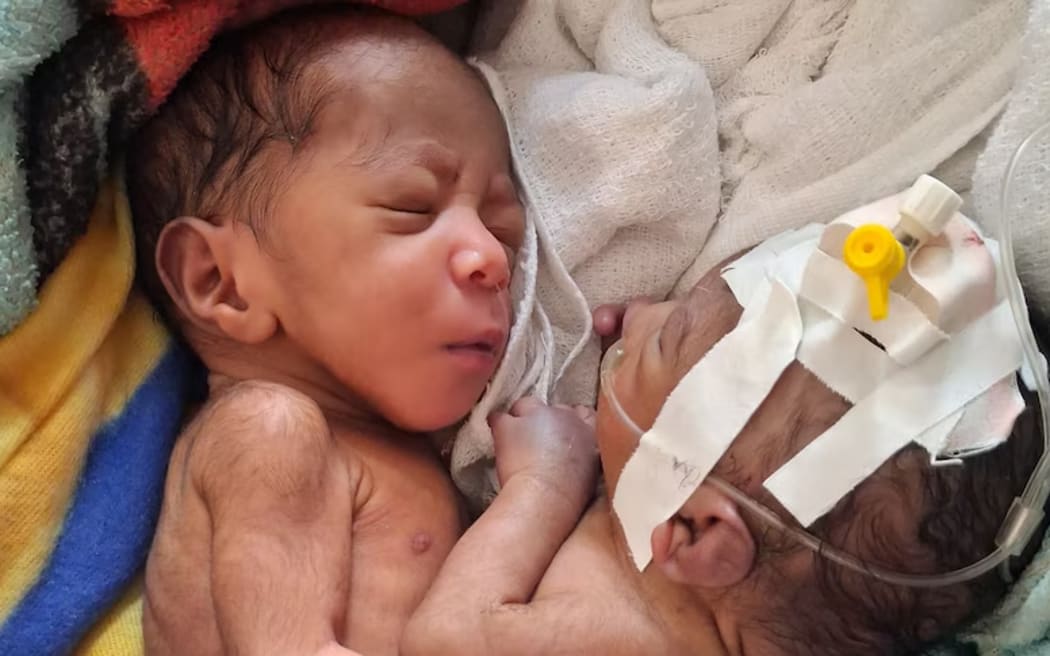 The newborn boys are expected to fly to Sydney for further medical treatment. (Supplied: Dr Kovei Umba)