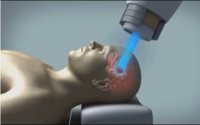 Proton Beam Therapy