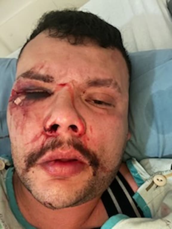 Julian Suarez says he was attacked in a hate crime at Auckland's Family Bar at the weekend.