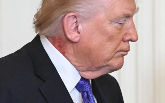 US President Donald Trump looks on during a Medal of Honor ceremony in the East Room of the White House on March 2, 2026, in Washington, DC. President Trump awarded the Medal of Honor to retired Army Command Sgt. Major Terry P. Richardson, who served in the Vietnam War, posthumously to Army Master Sgt. Roderick W. Edmonds, who served in World War II, and posthumously to Staff Sgt. Michael Ollis, who died in combat in Afghanistan in 2013. (Photo by SAUL LOEB / AFP)