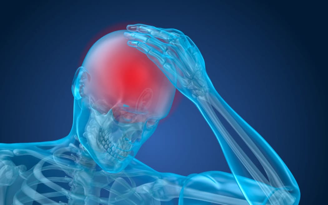 University of Otago researchers are studying rugby players who have experienced multiple bouts of concussion.