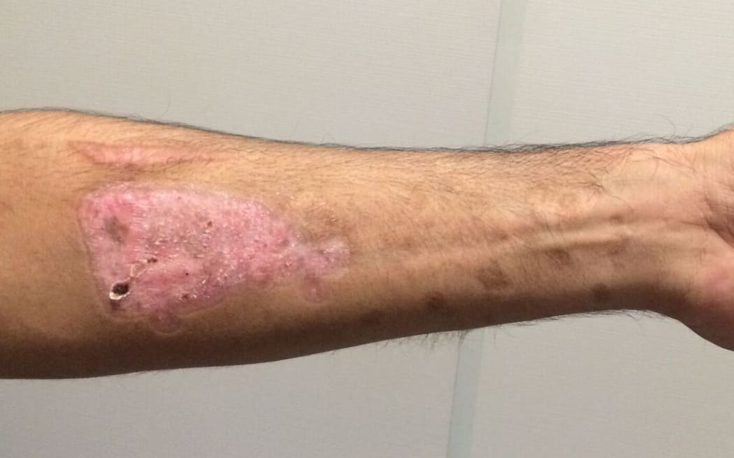 Injury reportedly suffered in Nauru.