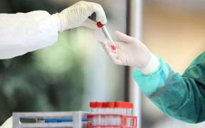 Medical staff member in rubber glowes hands out Coronavirus nasal swabs test tubes at drive-through testing point in an effort to curb the spread of COVID-19 (novel coronavirus)