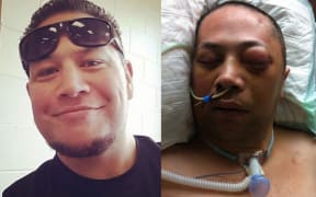 George Siaosi, before and after the punch.