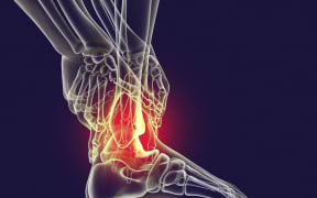 Man with foot pain and highlighted skeleton, computer illustration. (Photo by KATERYNA KON/SCIENCE PHOTO LIBRA / KKO / Science Photo Library via AFP)