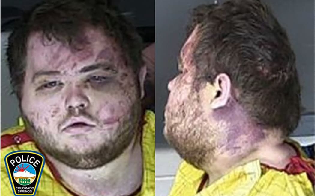 This handout photo released by the Colorado Springs Police Department on Novemver 23, 2022, shows the mugshot of Anderson Lee Aldrich, suspect in the club Q shooting. Aldrich has not been formally charged, but is being held on suspicion of murder. Under Colorado's judicial system, formal charges are not expected for another 10 days.
The hearing came less than four days after a gun-wielding attacker stormed Club Q in Colorado Springs, strafing customers and staff. (Photo by Colorado Springs Police Department / AFP) / RESTRICTED TO EDITORIAL USE - MANDATORY CREDIT "AFP PHOTO / HANDOUT / Colorado Springs Police Department" - NO MARKETING - NO ADVERTISING CAMPAIGNS - DISTRIBUTED AS A SERVICE TO CLIENTS