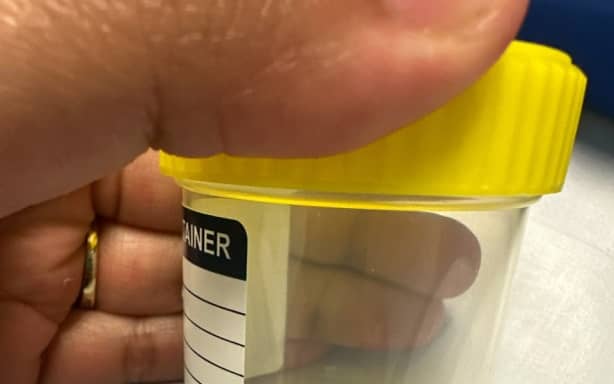 Stingray pierces fisher's boot with venomous barb | RNZ