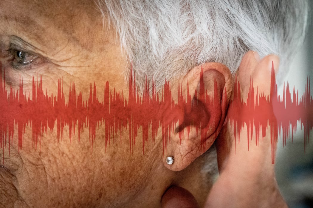 Close-up of the ear of a woman, with graphics representing sound waves 
 

GARO/PHANIE (Photo by GARO / Phanie / Phanie via AFP)